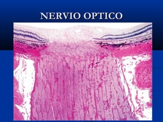 NERVIO OPTICO

 