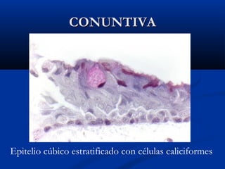 CONUNTIVA

Epitelio cúbico estratificado con células caliciformes

 