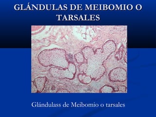 GLÁNDULAS DE MEIBOMIO O
TARSALES

Glándulass de Meibomio o tarsales

 