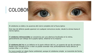 COLOBOMA
El coloboma se debe a la ausencia del cierre completo de la fisura óptica
Este tipo de defecto puede aparecer en cualquier estructura ocular, desde la córnea hasta el
nervio óptico.
El coloboma retinocoroideo se caracteriza por una abertura localizada en la retina,
generalmente por debajo de la papila óptica. bilateral en la mayoria.
El coloboma del iris es un defecto en la parte inferior del iris, en aspecto de ojo de cerradura.
Puede estar limitado al iris o bien se puede extender más profundamente hasta afectar al
cuerpo ciliar y a la retina.
Su causa puede ser algún factor ambiental, aunque el coloboma simple se transmite de forma
 