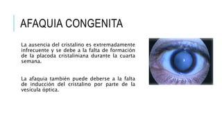 AFAQUIA CONGENITA
La ausencia del cristalino es extremadamente
infrecuente y se debe a la falta de formación
de la placoda cristaliniana durante la cuarta
semana.
La afaquia también puede deberse a la falta
de inducción del cristalino por parte de la
vesícula óptica.
 