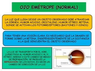 OOJJOO EEMMÉÉTTRROOPPEE ((NNOORRMMAALL)) 
LA LUZ QUE LLEGA DESDE UN OBJETO OBSERVADO DEBE ATRAVESAR 
LA CÓRNEA, HUMOR ACUOSO, CRISTALINO, HUMOR VÍTREO, RETINA, 
DONDE SE ACTIVAN LOS FOTORRECEPTORES (BASTONES Y CONOS) 
PARA TENER UNA VISIÓN CLARA, ES NECESARIO QUE LA IMAGEN SE 
FORME SOBRE LA RETINA, INDEPENDIENTEMENTE DE LA DISTANCIA 
A LA QUE SENCUENTRA EL OBJETO OBSERVADO 
LA LUZ SE TRANSPORTA POR EL AIRE, 
LUEGO PASA AL HUMOR ACUOSO Y AL H. 
VÍTREO, DEBIDO A ESTE CAMBIO DE MEDIO 
DE PROPAGACIÓN, SE PRODUCE LA 
REFRACCIÓN DE LOS RAYOS, ES DECIR UN 
CAMBIO DE DIRECCIÓN DE LA LUZ 
 