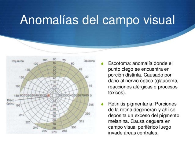 Resultado de imagen para trazado campimetrico