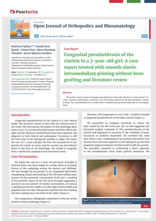 Open Journal of Orthopedics and Rheumatology
020
Citation: Ibrahima F, Handy Eone D, Fokam P, Nana Chunteng T, Sosso MA (2017) Congenital pseudarthrosis of the clavicle in a 7-year-old girl: A case report
treated with smooth elastic intramedullary pinning without bone grafting and literature review. Open J Orthop Rheumatol 2(1): 020-022.
DOI: http://dx.doi.org/10.17352/ojor.000011
Clinical Group
CC Byhttp://dx.doi.org/10.17352/ojor.000011DOI
Abstract
The authors report a case of congenital pseudarthrosis of the right clavicle in a 7-year-old girl. It is
a rare congenital malformation. Unanimity is far from being achieved on the best therapeutic method
to adopt. This case benefited from a stable elastic medullary pinning without graft with an encouraging
result.
Case Report
Congenital pseudarthrosis of the
clavicle in a 7-year-old girl: A case
report treated with smooth elastic
intramedullary pinning without bone
grafting and literature review
Ibrahima Farikou1,2
*, Handy Eone
Daniel1
, Fokam Pius2
, Nana Chunteng
Theophil1
, Sosso Maurice Aurélien1
1
Department of Surgery and Specialties, Faculty
of Medical and Biomedical Sciences, University of
Yaoundé I, Yaoundé, Cameroon
2
Department of Orthopedic Surgery, Douala General
Referral Hospital, Douala, Cameroon
Dates: Received: 21 September, 2017; Accepted: 10
October, 2017; Published: 11 October, 2017
*Corresponding author: Ibrahima Farikou, Depart-
ment of Surgery and Specialties, Faculty of Medical
and Biomedical Sciences, University of Yaoundé
I, Yaoundé, Cameroon, Tel: (237)699870267, Fax
:(237)222310579; E-mail:
https://www.peertechz.com
Introduction
Congenital pseudarthrosis of the clavicle is a rare clinical
entity. The literature reports to date only 200 clinical cases in
the world. The ﬁrst known description of this pathology dates
back to 1910. It is mostly described in girls and often affects the
right clavicle. Bilateral, familial forms have been reported. The
diagnosis is both clinical and radiological. Concensus is still
far from clear to the therapeutic attitude to adopt. We report
the case of a 7-year-old girl, the ﬁrst one encountered in our
practice for nearly 20 years, and the second case described in
Africa to the best of our knowledge. We treated it surgically
with a satisfactory anatomical and functional result.
Case Presentation
We report the case of a 7-year-old girl borne normally at
term but with a low birth weight of 2,200kg. There is no family
history of this pathology among the parents and sibblings.
She was brought by her parents to our outpatient department
complaining of pain and swelling of the left wrist without prior
trauma. On the systematic examination of this girl, a swelling
of the posterior aspect of the left wrist strongly suggesting a
synovial cyst was noticed. On further examination, we noticed
a swelling around the middle 1/3 of the right clavicle visible and
palpable under the skin. The parents reported that this swelling
has been existing since the birth of the child. (Figure 1).
The comparative radiographic assessment of the two wrists
showed no bone pathology (Figure 2).
However, the comparative x-ray of the 2 clavicles revealed
a congenital pseudarthrosis of the right clavicle (Figure 3).
We prescribed an analgesic treatment to relieve the
pain caused by the left wrist cyst. We as well suggested and
discussed surgical treatment of this pseudoarthrosis of the
clavicle and explained its necessity if she complains of pain,
functional or aesthetic discomfort. We reviewed this child
after about 1 year, complaining of an aesthetic discomfort that
became more and more apparent as the child grew up. We then
proposed surgical treatment and discussed it with the parents.
The procedure consisted in performing a direct approach
to the pseudarthrosis focus under general anesthesia. We
Figure 1: N.G., 7 years old, presenting with a palpable and visible swelling under the
skin around the middle 1/3 of the right clavicle (blue arrow).
 