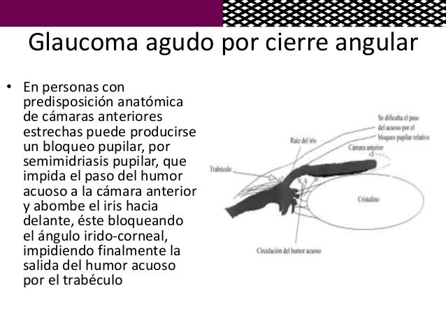 El programa malyshevoy sobre varikoze el vídeo