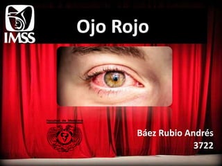 Ojo Rojo
Báez Rubio Andrés
3722
 