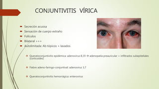 CONJUNTIVITIS VÍRICA
 Secreción acuosa
 Sensación de cuerpo extraño
 Folículos
 Bilateral +++
 Autolimitada: Ab tópicos + lavados
 Queratoconjuntivitis epidémica: adenovirus 8,19  adenopatía preauricular + infiltrados subepiteliales
(corticoides)
 Fiebre adeno-faringo-conjuntival: adenovirus 3,7
 Queratoconjuntivitis hemorrágica: enterovirus
 