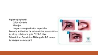 Higiene palpebral.
Calor húmedo
Masajes
Limpieza con productos especiales
Pomada antibiótica de eritromicina, aureomicina
...