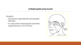 Linfadenopatía preauricular
Ganglios:
◦ localización dependiendo del párpado
afectado.
◦ en conjuntivitis hiperagudas (cla...