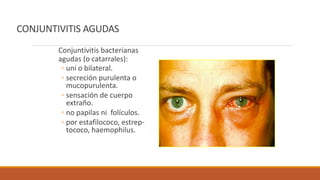 CONJUNTIVITIS AGUDAS
Conjuntivitis bacterianas
agudas (o catarrales):
◦ uní o bilateral.
◦ secreción purulenta o
mucopurul...