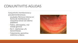 CONJUNTIVITIS AGUDAS
Conjuntivitis membranosas y
pseudomembranosas:
◦ exudados fibrinoso intenso en
forma de membranas en
...