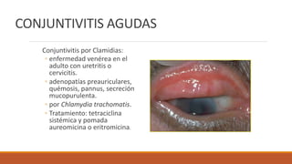 CONJUNTIVITIS AGUDAS
Conjuntivitis por Clamidias:
◦ enfermedad venérea en el
adulto con uretritis o
cervicitis.
◦ adenopat...