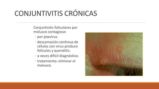 CONJUNTIVITIS CRÓNICAS
Conjuntivitis foliculares por
molusco contagioso:
◦ por poxvirus.
◦ descamación continua de
células...