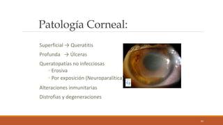 64
Patología Corneal:
Superficial → Queratitis
Profunda → Úlceras
Queratopatías no infecciosas
◦ Erosiva
◦ Por exposición ...