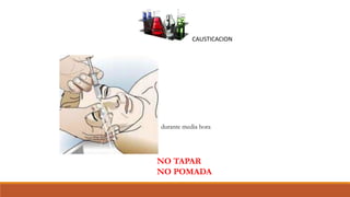 durante media hora
NO TAPAR
NO POMADA
CAUSTICACION
 