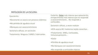 73
PATOLOGÍA DE LA ESCLERA:
Episcleritis:
•Raramente se asocia con proceso sistémico
•No pérdida de agudeza visual
•Blanqu...