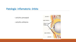 Patología inflamatoria órbita
- celulitis preseptal
- celulitis orbitaria
 