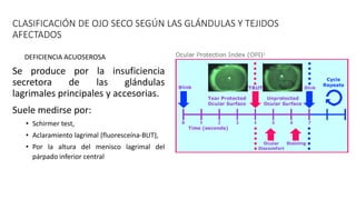 CLASIFICACIÓN DE OJO SECO SEGÚN LAS GLÁNDULAS Y TEJIDOS
AFECTADOS
Se produce por la insuficiencia
secretora de las glándulas
lagrimales principales y accesorias.
Suele medirse por:
• Schirmer test,
• Aclaramiento lagrimal (fluoresceína-BUT),
• Por la altura del menisco lagrimal del
párpado inferior central
DEFICIENCIA ACUOSEROSA
 
