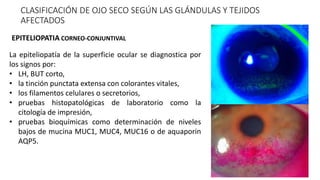 CLASIFICACIÓN DE OJO SECO SEGÚN LAS GLÁNDULAS Y TEJIDOS
AFECTADOS
La epiteliopatía de la superficie ocular se diagnostica por
los signos por:
• LH, BUT corto,
• la tinción punctata extensa con colorantes vitales,
• los filamentos celulares o secretorios,
• pruebas histopatológicas de laboratorio como la
citología de impresión,
• pruebas bioquímicas como determinación de niveles
bajos de mucina MUC1, MUC4, MUC16 o de aquaporin
AQP5.
EPITELIOPATIA CORNEO-CONJUNTIVAL
 
