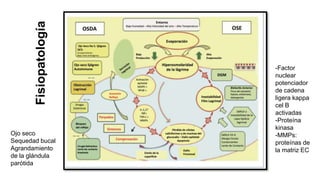 Fisiopatología
Ojo seco
Sequedad bucal
Agrandamiento
de la glándula
parótida
-Factor
nuclear
potenciador
de cadena
ligera kappa
cel B
activadas
-Proteína
kinasa
-MMPs:
proteínas de
la matriz EC
 