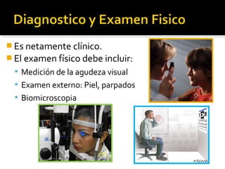  Es netamente clínico.
 El examen físico debe incluir:
 Medición de la agudeza visual
 Examen externo: Piel, parpados
 Biomicroscopia
 