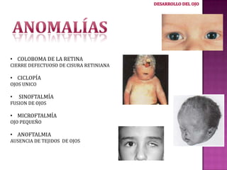 • COLOBOMA DE LA RETINA
CIERRE DEFECTUOSO DE CISURA RETINIANA

• CICLOPÍA
OJOS UNICO

•

SINOFTALMÍA

FUSION DE OJOS

• MICROFTALMÍA
OJO PEQUEÑO

• ANOFTALMIA
AUSENCIA DE TEJIDOS DE OJOS

 