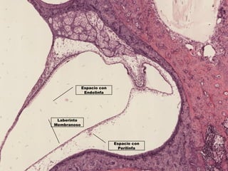 Espacio con
Perilinfa
Laberinto
Membranoso
Espacio con
Endolinfa
 
