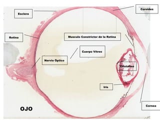 Cuerpo Vítreo 
Iris 
Musculo Constrictor de la Retina 
Nervio Óptico 
Cornea
Cristalino
Esclera
Coroides
Retina
OJO
 