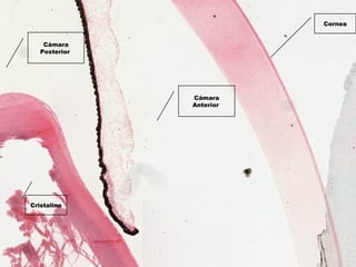 Cámara
Anterior 
Cámara
Posterior 
Cornea
Cristalino
 