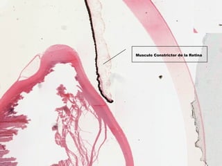 Musculo Constrictor de la Retina
 