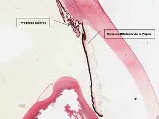 Musculo Dilatador de la Pupila 
Procesos Ciliares
 