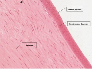 Estroma
Membrana de Bowman 
Epitelio Anterior 
 