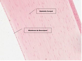 Membrana de Descement
Endotelio Corneal
 