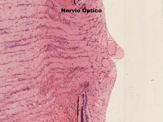 Nervio Óptico
 