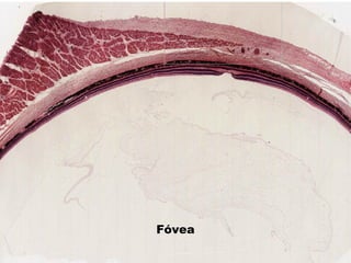 Fóvea
 