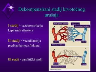 DDeekkoommppeennzziirraannii ssttaaddiijj kkrrvvoottooččnnoogg 
uurruuššaajjaa 
I stadij - vazokonstrikcija 
kapilarnih sfinktera 
II stadij - vazodilatacija 
predkapilarnog sfinktera 
III stadij - paralitički stadij 
Predkapilarni sfinkteri Glavni put 
Arteriole 
Kapilare 
Venule 
A Sfinkter relaksiran 
Arteriole Venule 
B Sfinkter kontrahiran 
Postkapilarni sfinkteri 
 