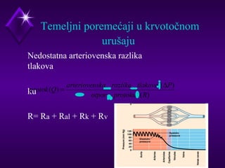 Temeljni poremećaji u krvotočnom 
urušaju 
 Nedostatna arteriovenska razlika 
tlakova 
protok Q = arteriovenska razlika tlakovai DP 
 ku 
( ) _ _ ( ) 
otpor protokuh R 
 R= Ra + Ral + Rk + Rv 
_ ( ) 
 