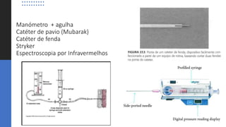 Manómetro + agulha
Catéter de pavio (Mubarak)
Catéter de fenda
Stryker
Espectroscopia por Infravermelhos
 