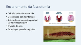 Encerramento da fasciotomia
• Oclusão primária retardada
• Cicatrização por 2a intenção
• Sutura de aproximação gradual
(shoelace technique)
• Enxerto de pele
• Terapia por pressão negativa
 