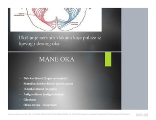 Ukrštanje nervnih vlakana koja polaze iz
lijevog i desnog oka
MANE OKA
• Dalekovidnost (hypermetropia) i
• Staračka dalekovidnost (presbyopia)
• Kratkovidnost (myopia)
• Astigmatizam (astigmatismus)
• Glaukom
• Očna mrena – katarakta
https://cdn.fbsbx.com/v/t59.2708-21/18281881_695942740591758_414984647569152…KO-PREZENTACIJA.pptx?oh=2ae3a9a17b1adae8b19a7f1075d01ee1&oe=591D3B93&dl=1 16.05.2017. 19S26
Stranica 14 od 22
 