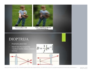 DIOPTRIJA
• Dioptrijska jakost leće
• Jakosti leće D je recipročna
vrijednost žarišne daljine izražene u
metrima
https://cdn.fbsbx.com/v/t59.2708-21/18281881_695942740591758_414984647569152…KO-PREZENTACIJA.pptx?oh=2ae3a9a17b1adae8b19a7f1075d01ee1&oe=591D3B93&dl=1 16.05.2017. 19S26
Stranica 19 od 22
 