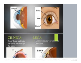 ŽILNICA
• Prokrvljena središnja
ovojnica, nastavak je
šarenice
LEĆA
• Lomi i usmjerava svjetlost na
mrežnicu
https://cdn.fbsbx.com/v/t59.2708-21/18281881_695942740591758_414984647569152…KO-PREZENTACIJA.pptx?oh=2ae3a9a17b1adae8b19a7f1075d01ee1&oe=591D3B93&dl=1 16.05.2017. 19S26
Stranica 8 od 22
 