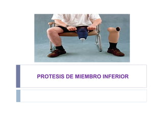 PROTESIS DE MIEMBRO INFERIOR
 