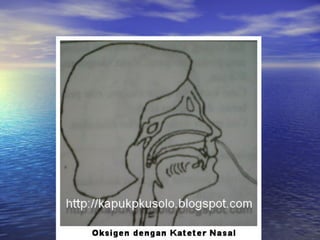 Oksigenasi, nebu & fisioterafi dada