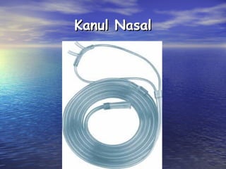 Kanul Nasal

 