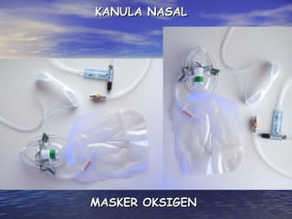 KANULA NASAL

MASKER OKSIGEN

 