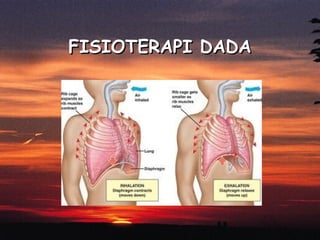 FISIOTERAPI DADA

 