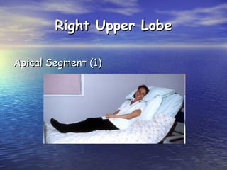 Right Upper Lobe
Apical Segment (1)

 