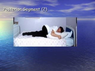 Posterior Segment (2)

 