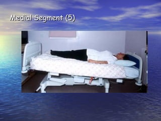 Medial Segment (5)

 